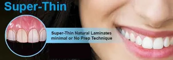thin veneers